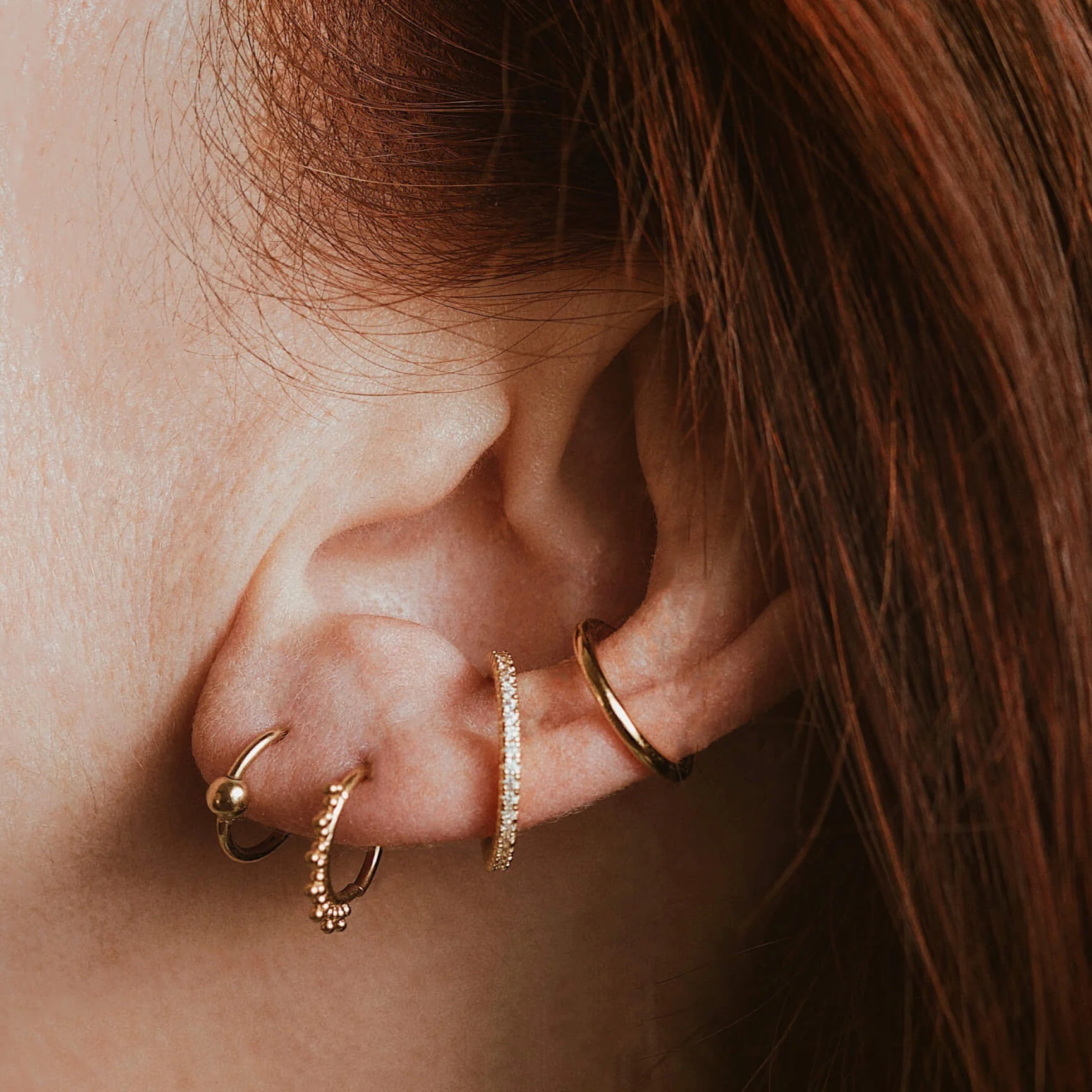 Orbital Cartilage Hoop - Image 2